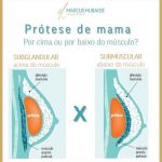 Prótese mamária