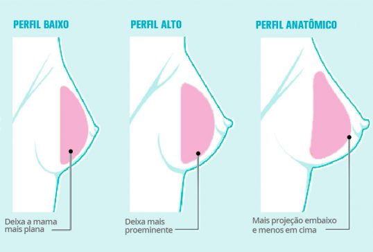 protese-de-mama