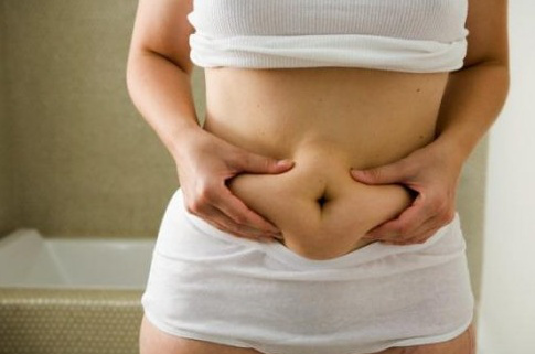 Abdominoplastia após a gravidez