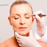 Lifting facial: saiba tudo sobre a técnica