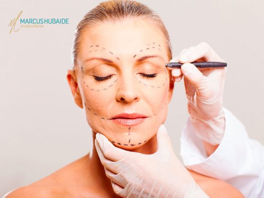 Lifting facial: saiba tudo sobre a técnica